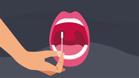 how to test for std in throat