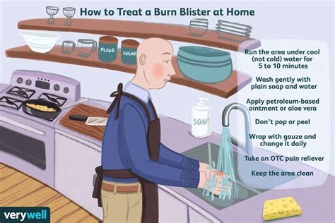 how to treat a burn blister