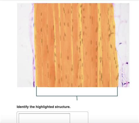 identify the highlighted structure.