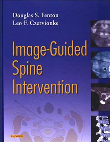 image guided spine interventions image guided spine interventions PDF