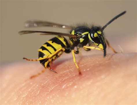 images of a bee sting