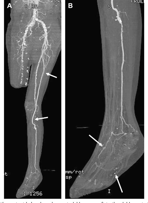 imaging of lower extremity issue of Kindle Editon