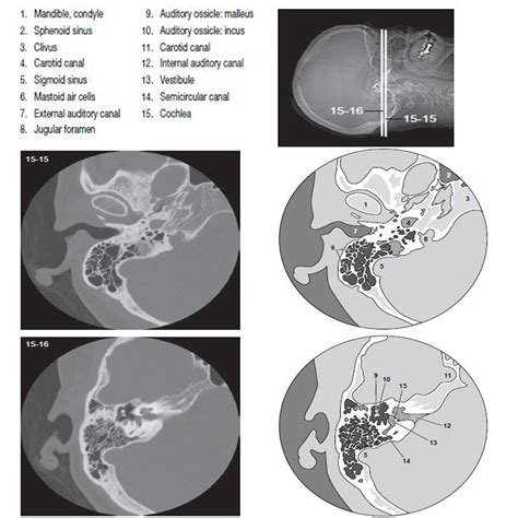imaging of the temporal bone imaging of the temporal bone Kindle Editon
