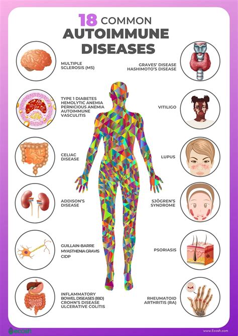 immune system diseases list