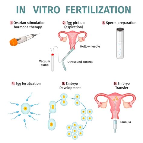 in vitro fertilization in vitro fertilization Kindle Editon