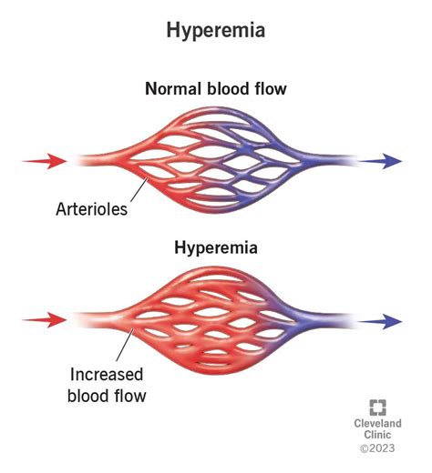 increased blood flow