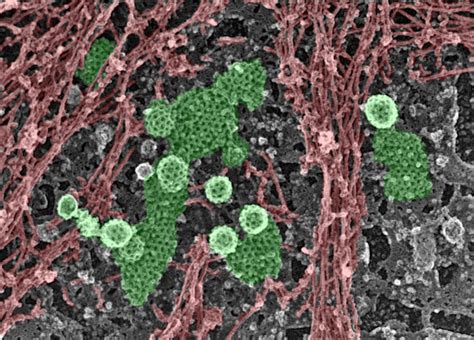 infectious disease internships