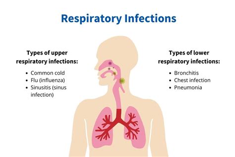 infectious diseases of the respiratory tract Epub