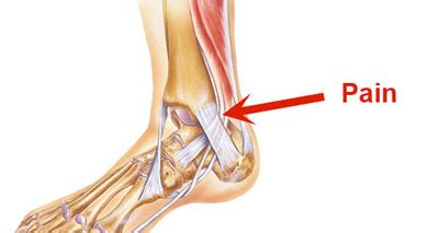 inner ankle pain