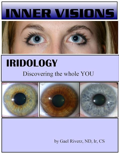 inner visions iridology discovering the whole you Kindle Editon