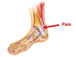 inside ankle pain running