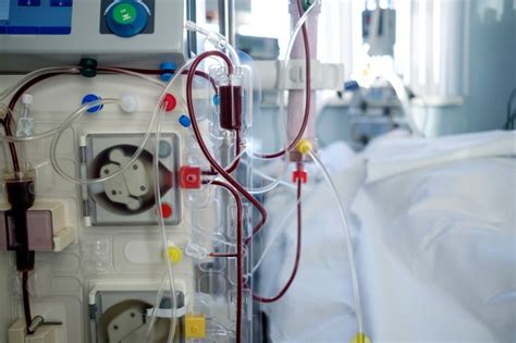intensive care in nephrology intensive care in nephrology Doc