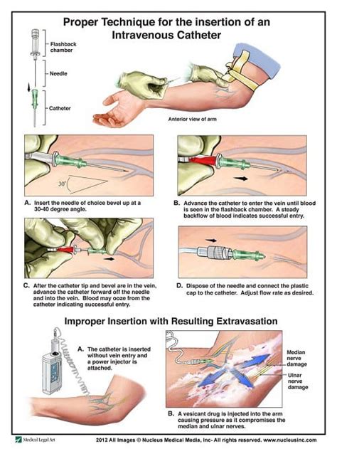 intravenous therapy in nursing practice Epub