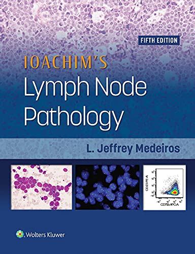 ioachim s lymph node pathology ioachim s lymph node pathology Kindle Editon