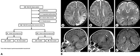 ischaemic lesions in the premature infant correlation of imaging and outcome Doc