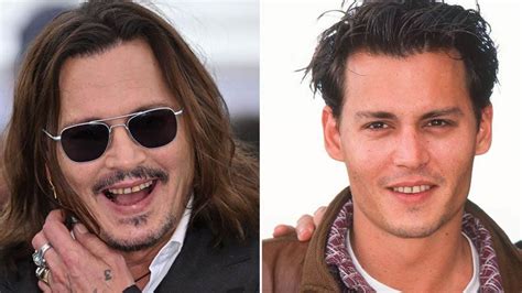 johnny depp teeth before and after