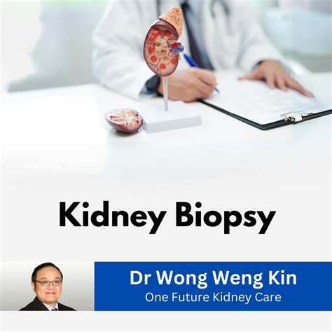 kidney specialist singapore