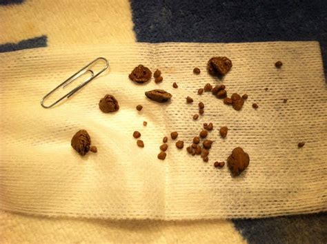 kidney stones in cats