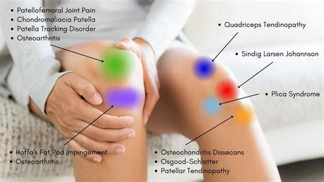 knee pain when to see a doctor