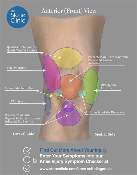 knee pain when walking no swelling