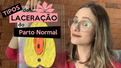 laceração de grau 2