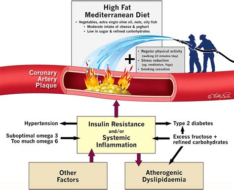 lipids and coronary heart disease Doc