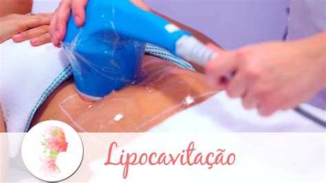 lipocavitação funciona