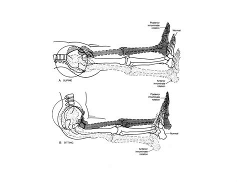 long sit test