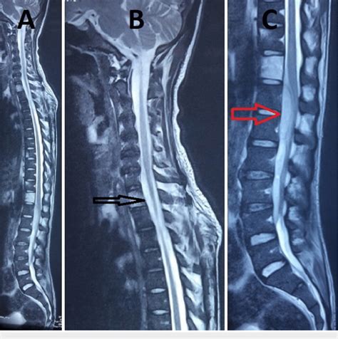 magnetic resonance imaging of the spine Kindle Editon