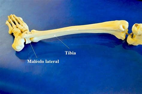 maléolo lateral