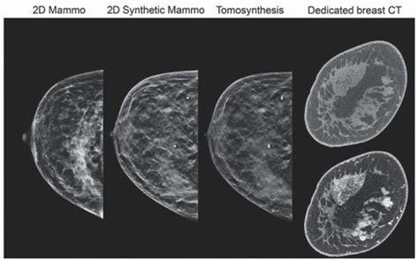 mammographic imaging mammographic imaging Doc