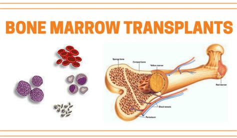 manual of stem cell and bone marrow transplantation Kindle Editon