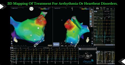 mapping of the heart bg3