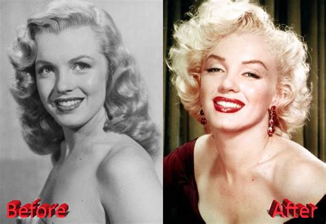 marilyn monroe plastic surgery