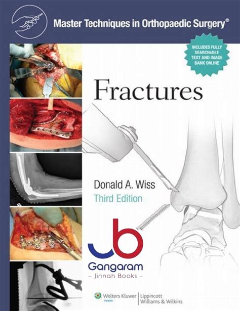 master techniques in orthopaedic surgery fractures Reader