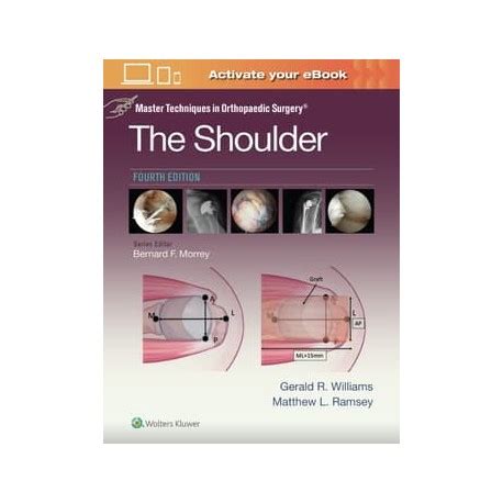 master techniques in orthopaedic surgery shoulder Kindle Editon