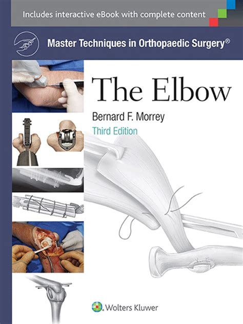 master techniques in orthopaedic surgery the elbow Kindle Editon