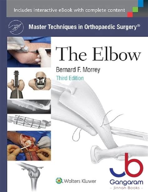 master techniques in orthopaedic surgery the elbow Kindle Editon