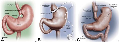 master techniques in surgery gastric surgery Epub