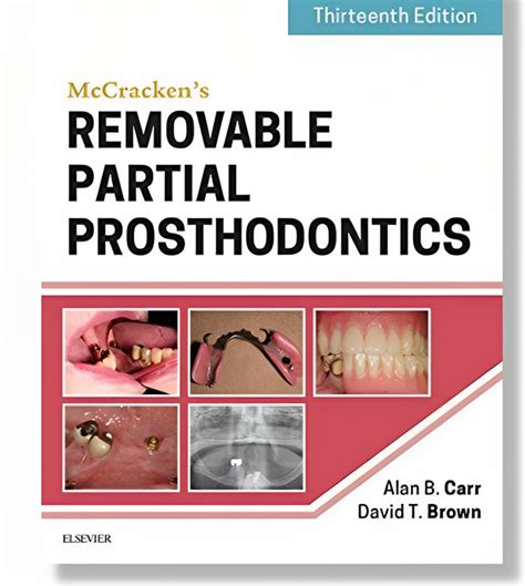mccrackens removable partial prosthodontics 13e Kindle Editon