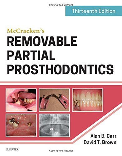 mccrackens removable partial prosthodontics 13e Kindle Editon