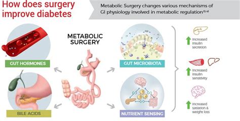 metabolic syndrome diabetes surgical management Reader