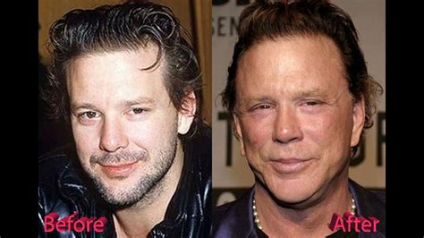 mickey rourke before after