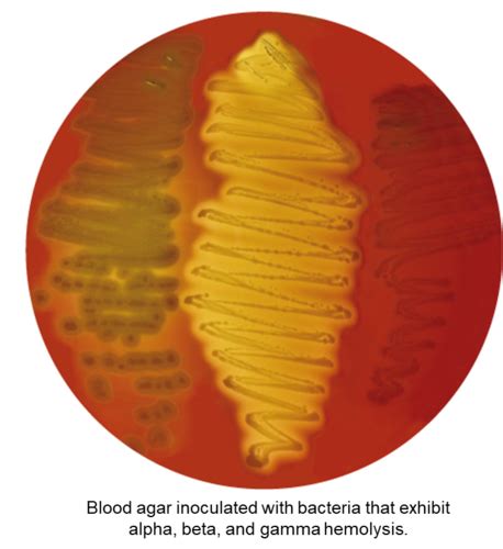 microbiology chapter 7 quizlet Doc