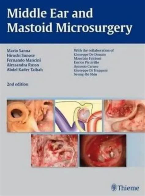 middle ear and mastoid microsurgery Reader