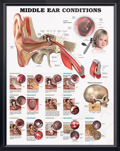 middle ear conditions anatomical chart Reader