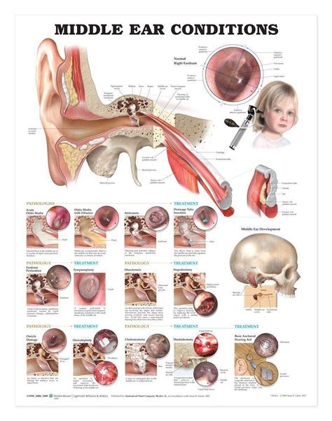 middle ear conditions anatomical chart Reader