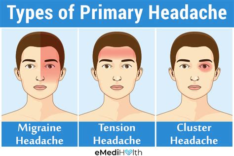 migraine and other primary headaches Doc
