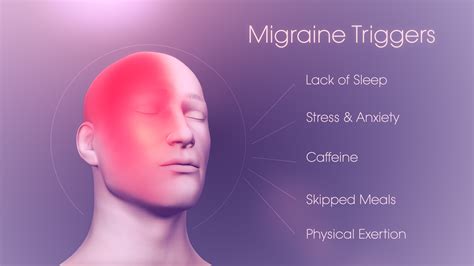 migraine on right side of head