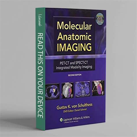 molecular anatomic imaging molecular anatomic imaging Epub